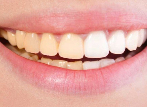 TCOCIA 8 除渍美白试验