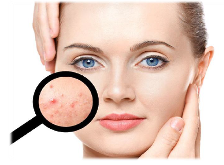 化妆品功效测试——抗痘与控油临床测试