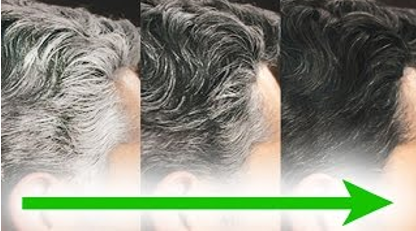 头皮组织及毛发产品——抗灰发功效评测