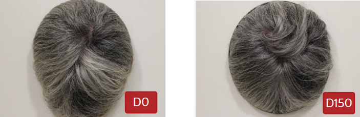 头皮组织及毛发产品——抗灰发功效评测