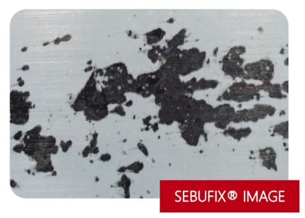 头皮组织及毛发产品——临床头屑评估