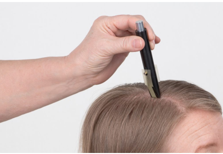 头皮组织及毛发产品——临床头屑评估