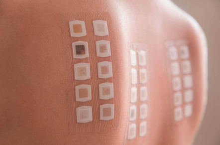 HRIPT/RIPT 人体重复刺激斑贴试验