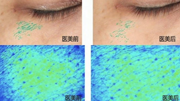 加乘延长医美效果护肤品—补水，皮肤光泽，改善皮肤纹路评价方案