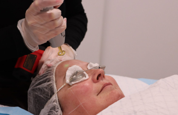 医美术后急护护肤品—即刻舒缓功效评价方案