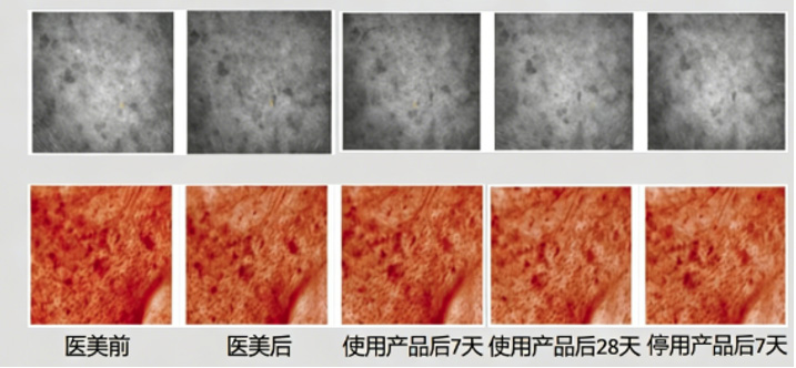 医美术后急护护肤品—防反黑功效评价方案