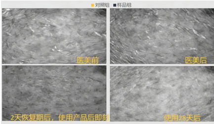 加乘延长医美效果护肤品—改善皮肤粗糙度评价方案