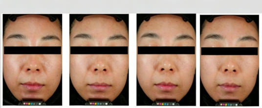 加乘延长医美效果护肤品—延长美白效果评价方案