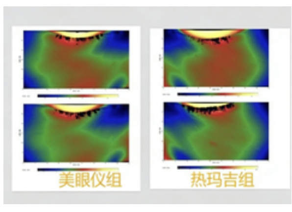 媲美医美效果护肤品——改善眼部皱纹、黑眼圈、眼袋效果评价方案