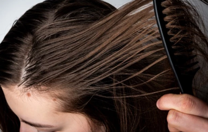 头皮组织及毛发产品——油性头皮皮脂分泌量的定量检测