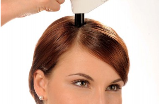 头皮组织及毛发产品——油性头皮皮脂分泌量的定量检测