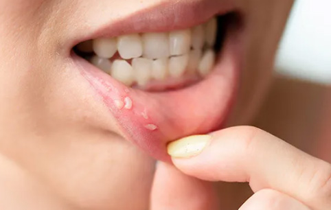 口腔黏膜刺激试验方法