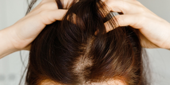 头皮组织及毛发产品——产品残留评估