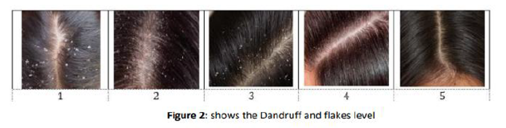 头皮组织及毛发产品——产品残留评估