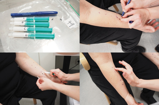 ROAT（Repeated Open Application Test，重复开放性测试）