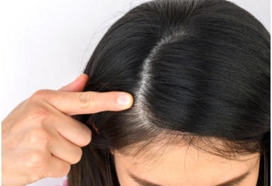 毛发及相关组织——头皮功效测试