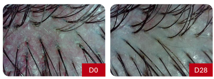 毛发及相关组织——头皮功效测试