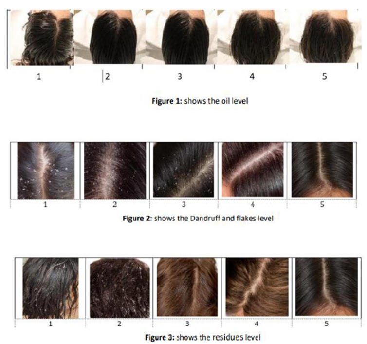 毛发及相关组织——头皮功效测试