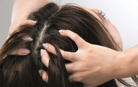 头皮组织及毛发产品——敏感性头皮评测方案