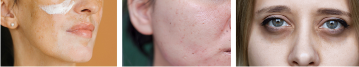 改善肤质与肤色功效临床测试（专于皮肤颜色变化评估）