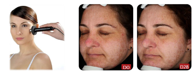 改善肤质与肤色功效临床测试（专于皮肤颜色变化评估）