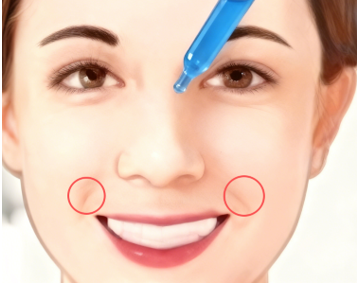 刺痛测试Stinging Test